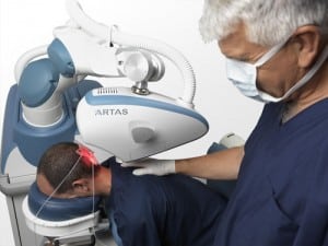 Frequently Asked Questions About ARTAS® Hair Transplant
