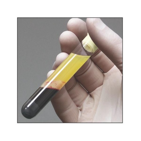 Read more about the article Hair Loss Treatment 2013: What’s New at the Miami Hair Institute