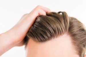 Hair Plug Transplants vs. Follicular Unit Extraction (FUE) 