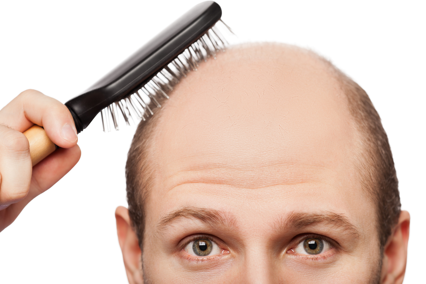 Read more about the article 4 Hair Loss Myths Everyone Should Ignore