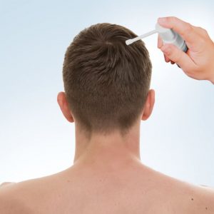 Minoxidil 