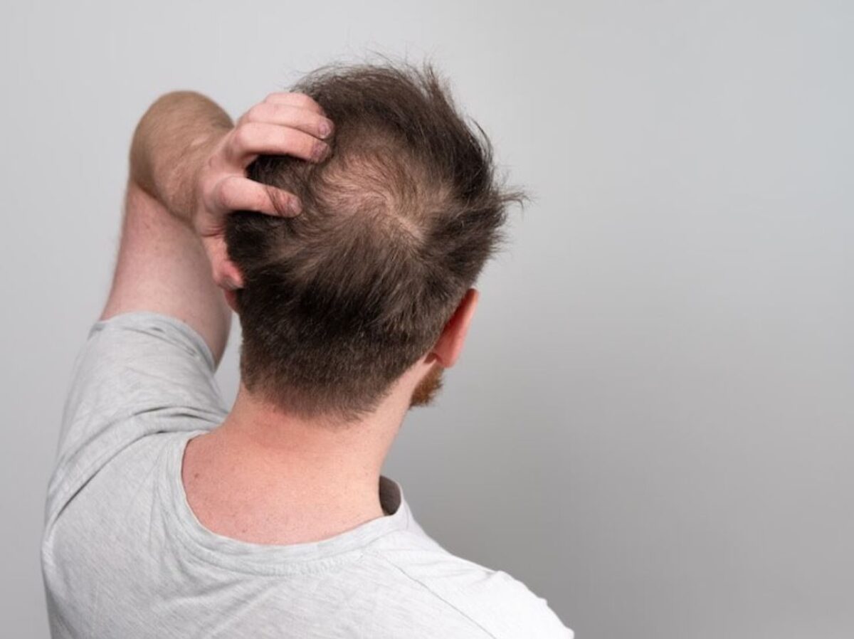 man-touching-his-head-1200x898.jpg