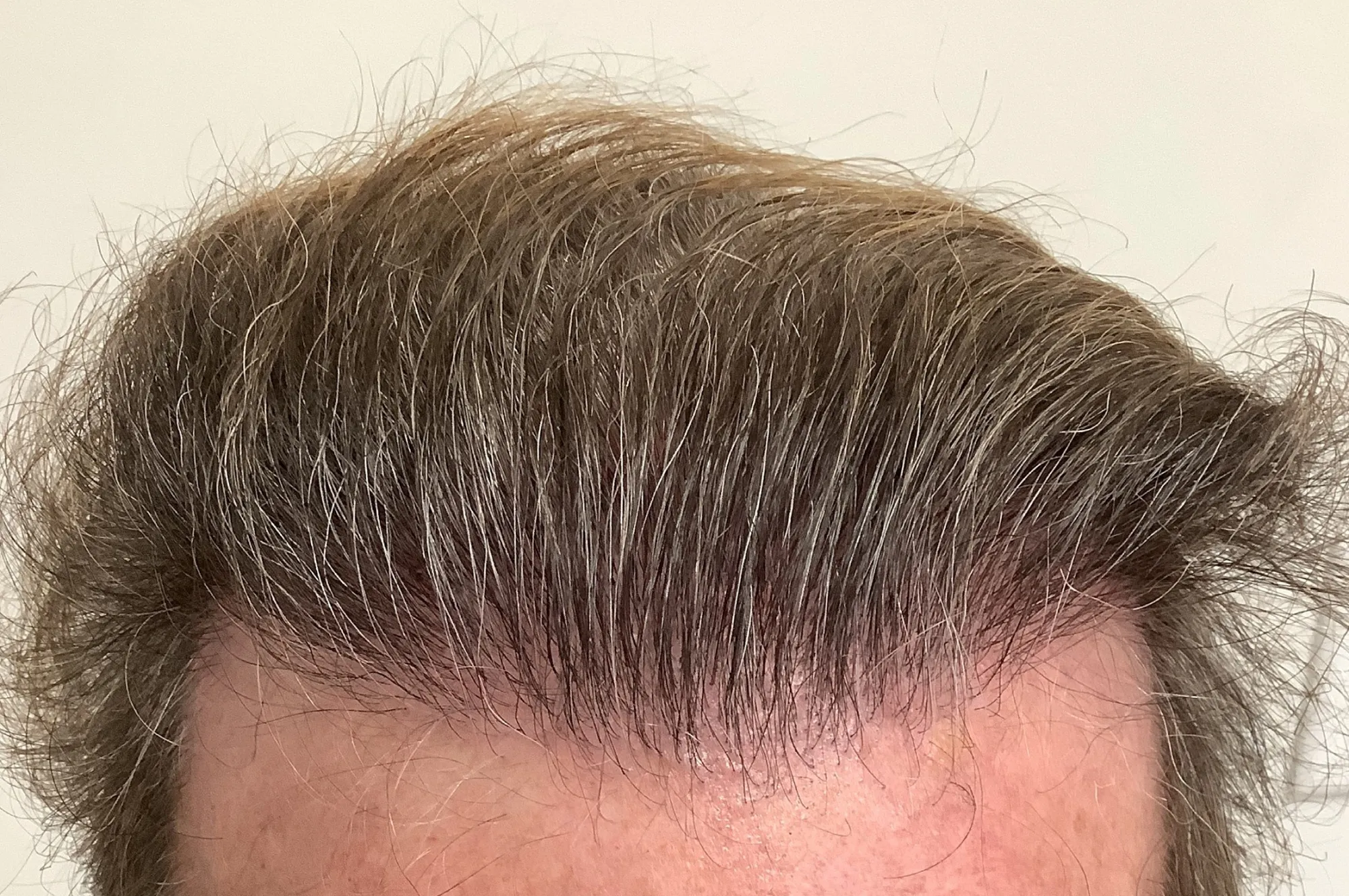 strip 2110 a