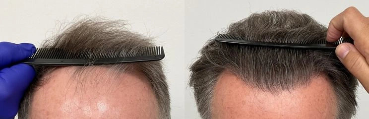 strip 3100