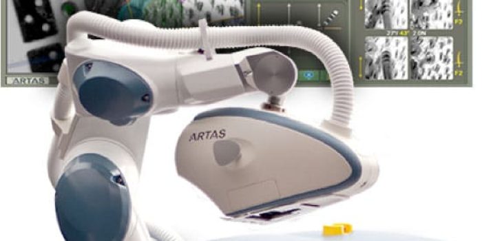 Robotic surgical system featuring an articulated robotic arm designed for precision in minimally invasive procedures. The image shows the robotic arm alongside a digital interface displaying various surgical metrics and visuals. This advanced technology enhances surgical accuracy, reduces recovery times, and improves patient outcomes in various medical applications. Ideal for healthcare professionals and medical technology enthusiasts, this image highlights innovation in robotic surgery.