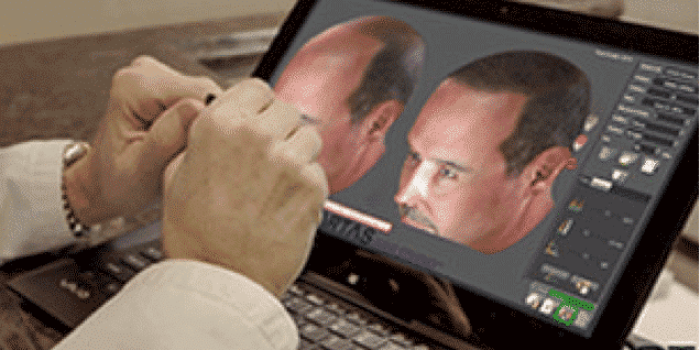 A person in a white coat is using a digital tablet to design or simulate a hair restoration procedure. The screen displays a detailed 3D model of a man's head showing different hairline options and styles. This image illustrates advanced technology in hair restoration, highlighting the precision and customization available in modern cosmetic procedures. The setting appears professional, indicating a focus on patient consultation and treatment planning.
