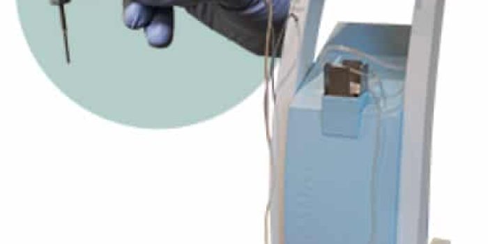 A healthcare professional wearing blue gloves operates a medical device, showcasing precise hand control. The device is a modern piece of equipment used for therapeutic procedures, featuring a sleek design and intuitive interface. It is connected to a power source, indicating its functionality in a clinical setting. The image highlights the importance of advanced medical technology in enhancing patient care and treatment efficiency.